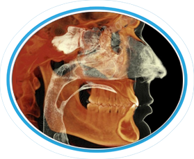 3D imaging for Dental Sleep Medicine Treatment