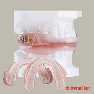 Detnal Sleep Device -Oral Appliance Therapy